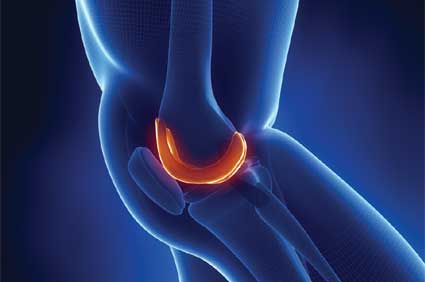 Medical Tourism in the Turks and Caicos includes knee arthroscopy.